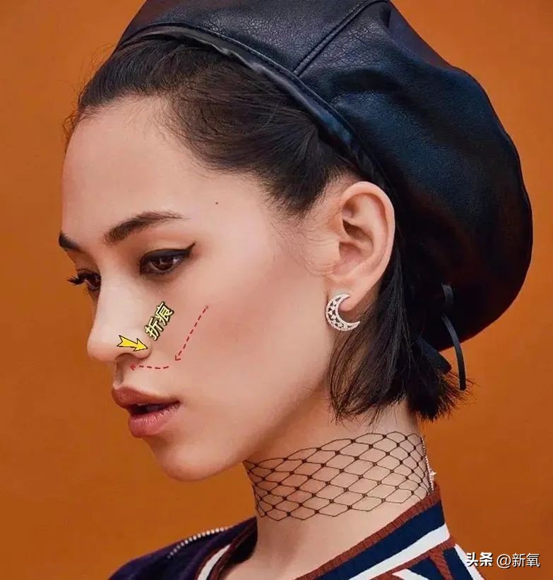 牙齿正畸和骨骼正畸的区别,牙齿正畸和眼轴增长有关系吗