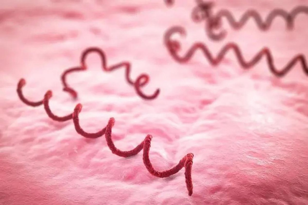 水银为什么能治疗梅毒,中世纪水银治疗梅毒