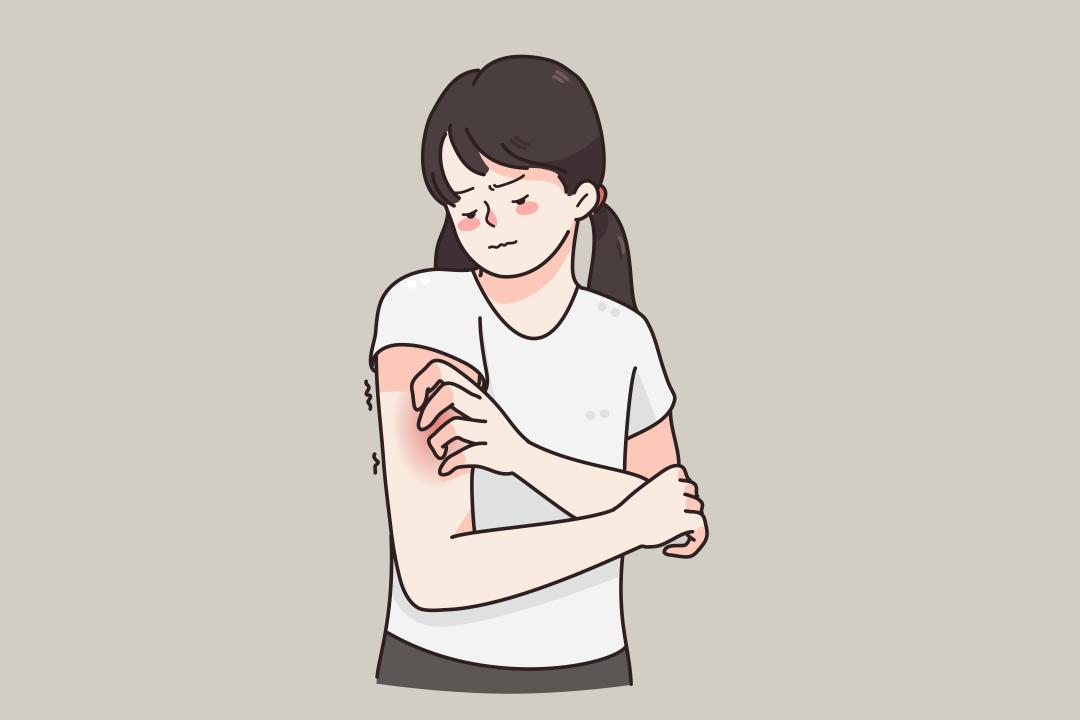 麻疹有什么忌口,麻疹饮食要注意一百天吗