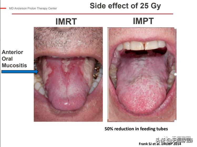 5年生存率超过90%是不是治疗率高,5年生存率图