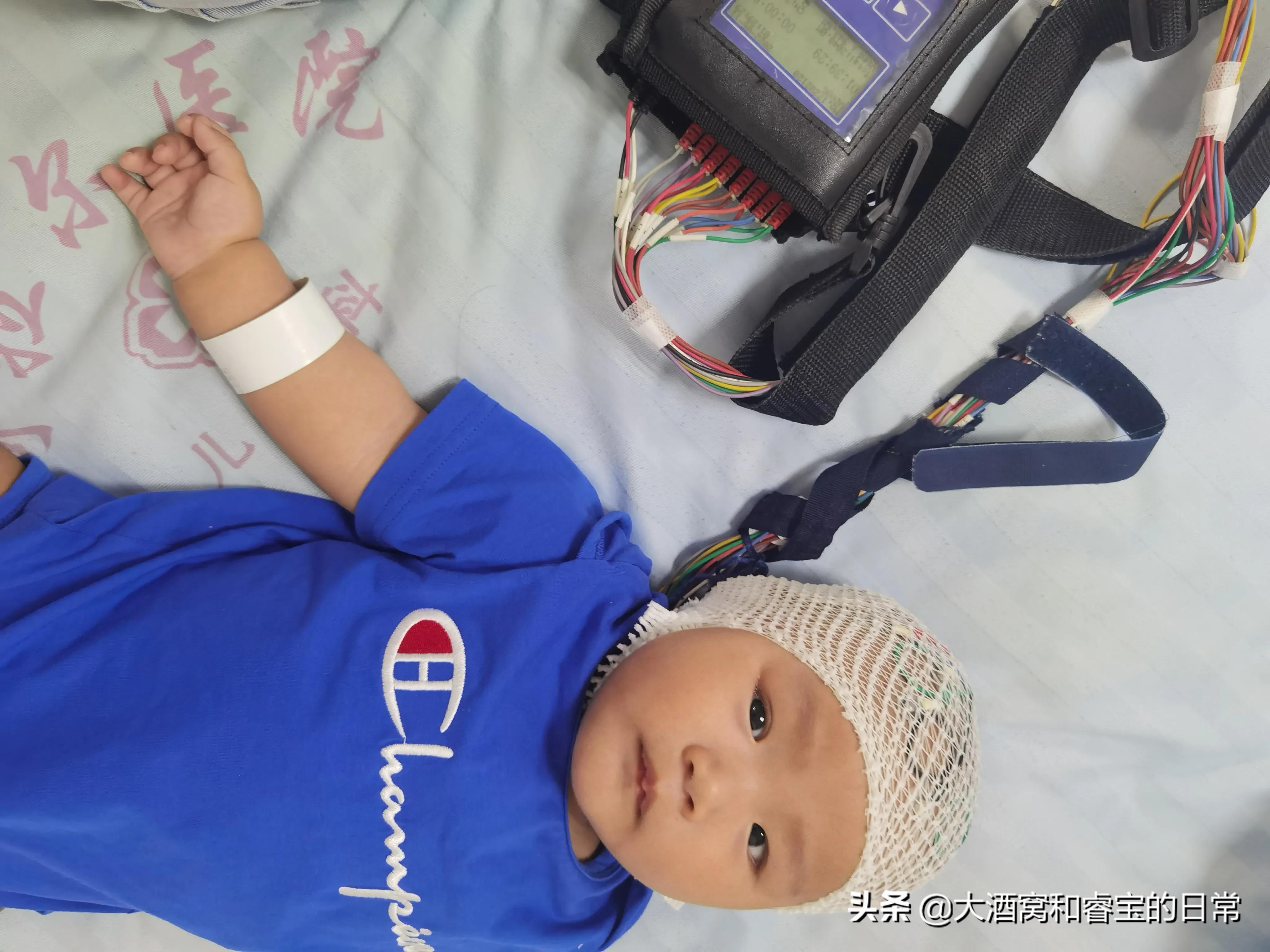 7个月宝宝疑似癫痫的第四天