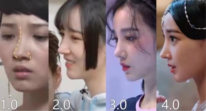 盘点整容失败惨不忍睹的30位女星,那些整容整失败的女明星