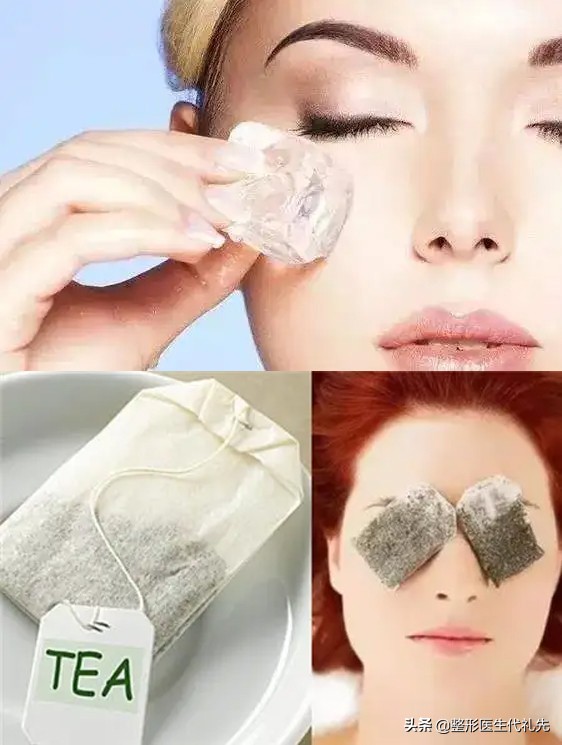 眼袋贴消除眼袋正品效果好,消除眼袋的方法有哪些