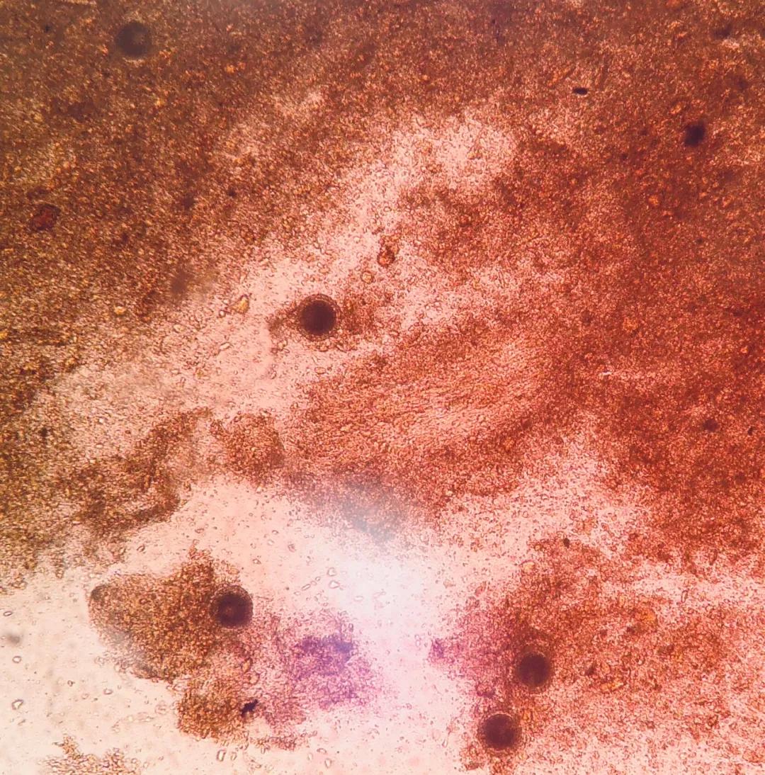 吃了驱虫药之后却没有拉虫子出来,吃了驱虫药没有任何反应