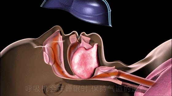 冬季怎样保护呼吸系统,使用呼吸机对身体有哪些好处