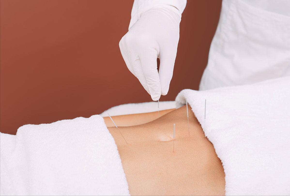 针灸临床经验选编精华,古法针灸临床治验