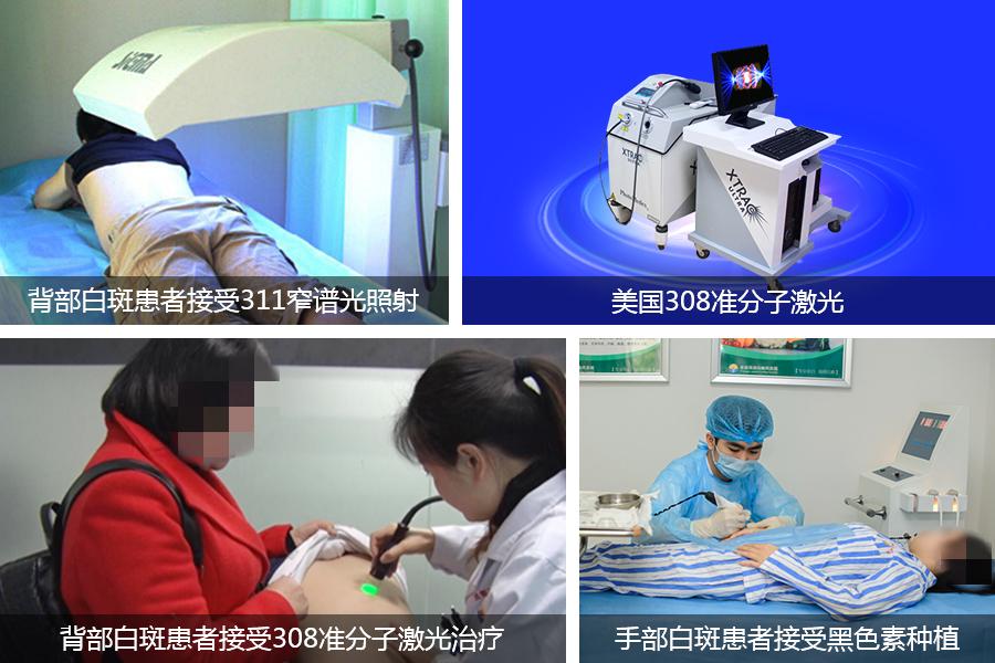 白癜风吃中药好还是西药好,中药和西药治疗白癜风哪个好