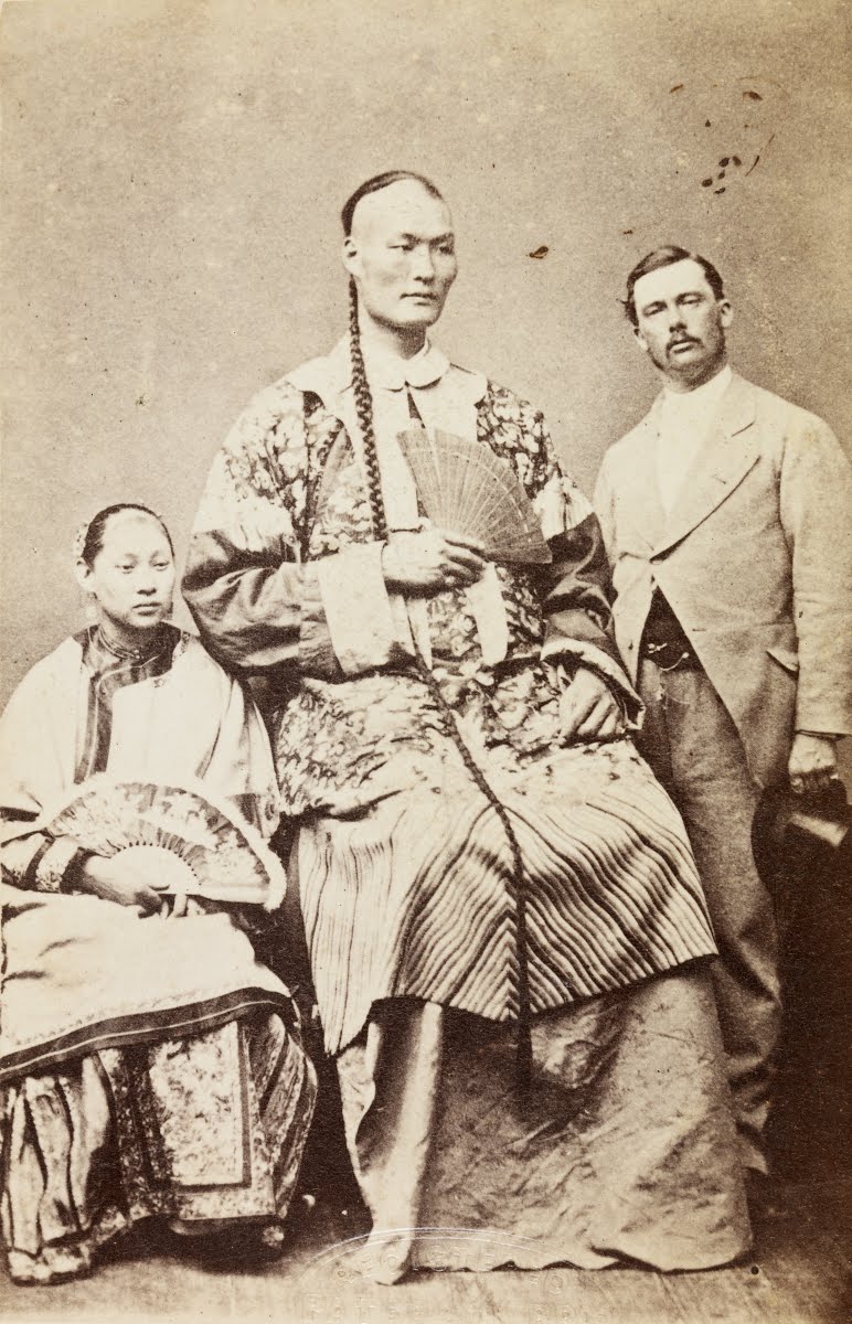 世界身高最高的10个人,盘点世界上最高的人3米61