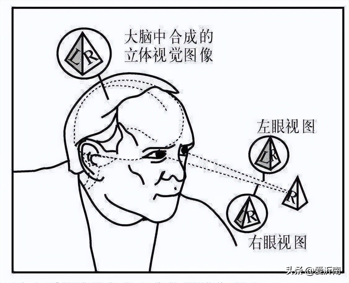 孩子两只眼睛度数相差100度,左右眼度数相差100
