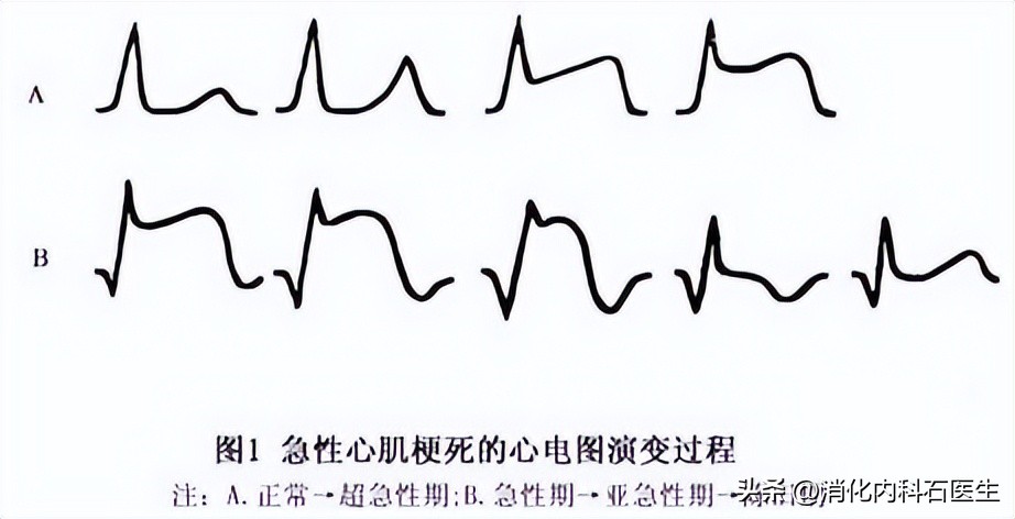 61岁男子咽痛,凌晨厕所晕倒被插管,医生:他差点被大便憋死