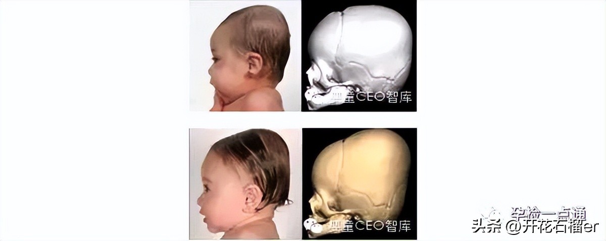 小月龄宝宝习惯把屎把尿如何纠正,8个月宝宝把屎把尿到底好不好