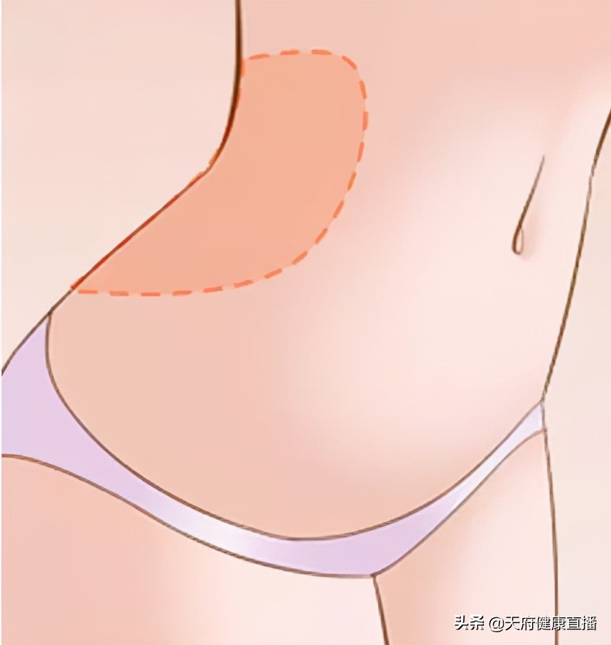 吸脂会皮肤松,吸脂太多可以脂肪填充补回来吗