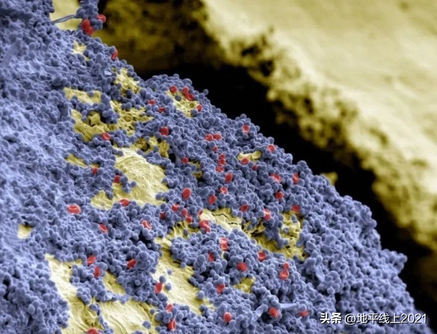 关于根管治疗的各种情况,根管治疗你不知道的秘密