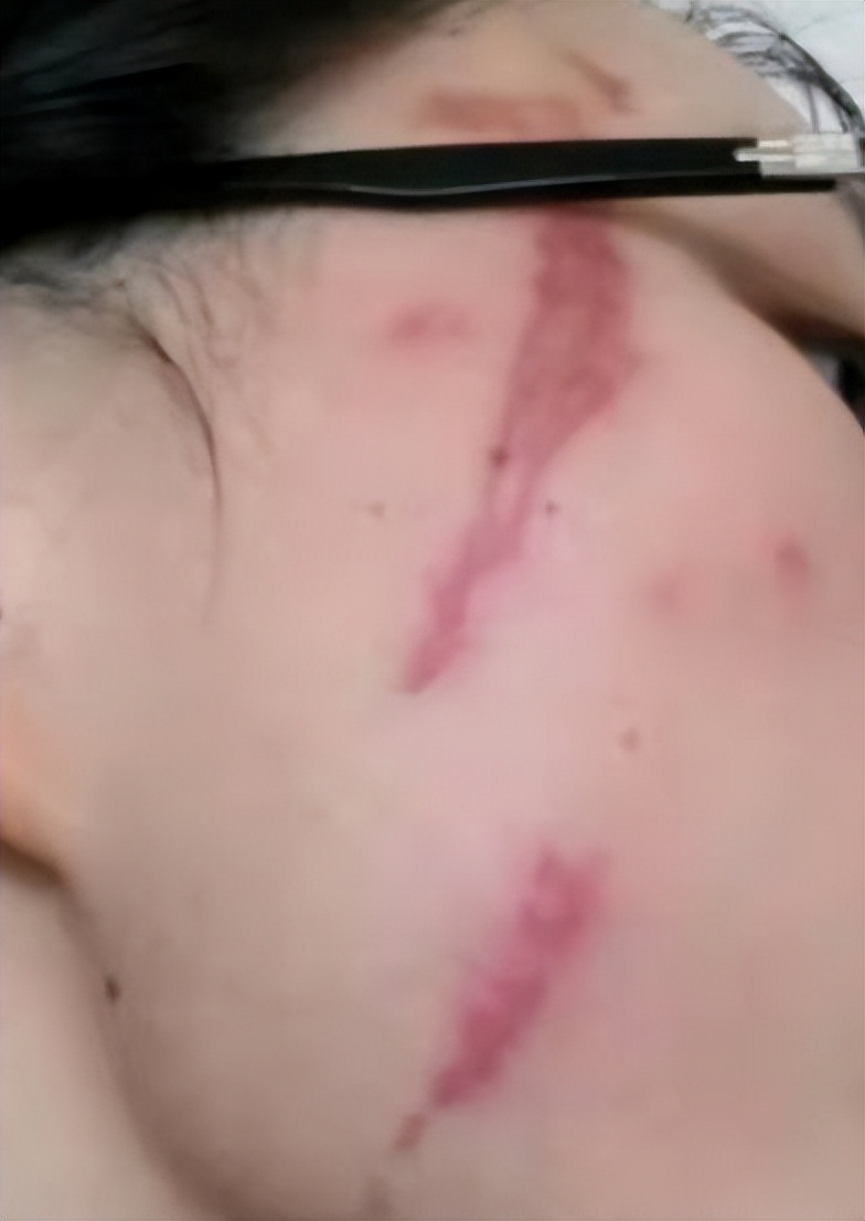 夏天碰到这种小虫子要警惕,这些常见又危险的小虫子