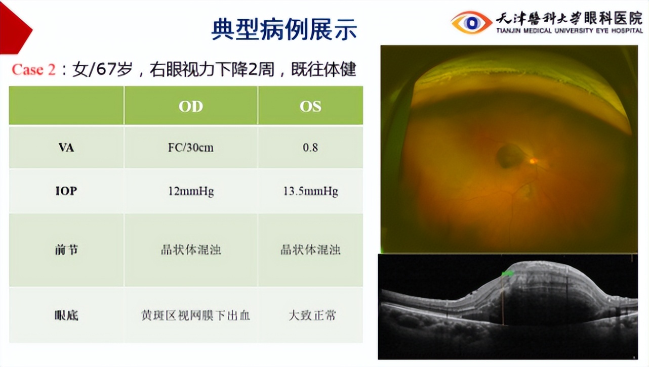 李筱荣教授,天津医科大学眼科医院李筱荣