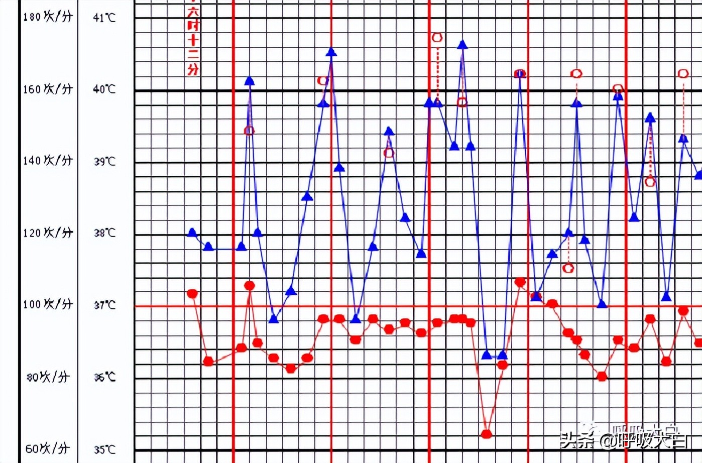 鹦鹉热病例分享,鹦鹉热怎么用药
