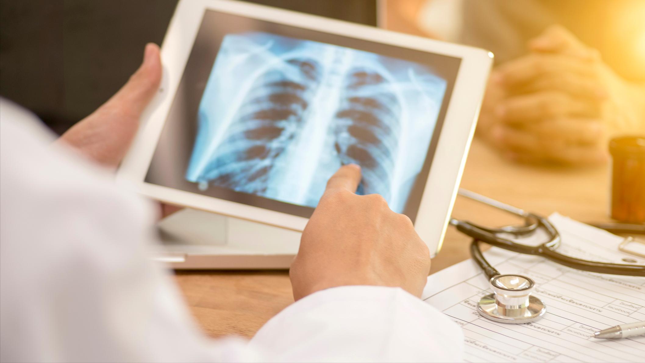 肺部有痰咳不出来的解决妙招,肺部咳出很多痰是快好了么