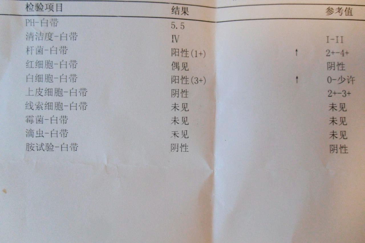 白带常规和分泌物检查的区别,白带分泌物检查报告怎么看