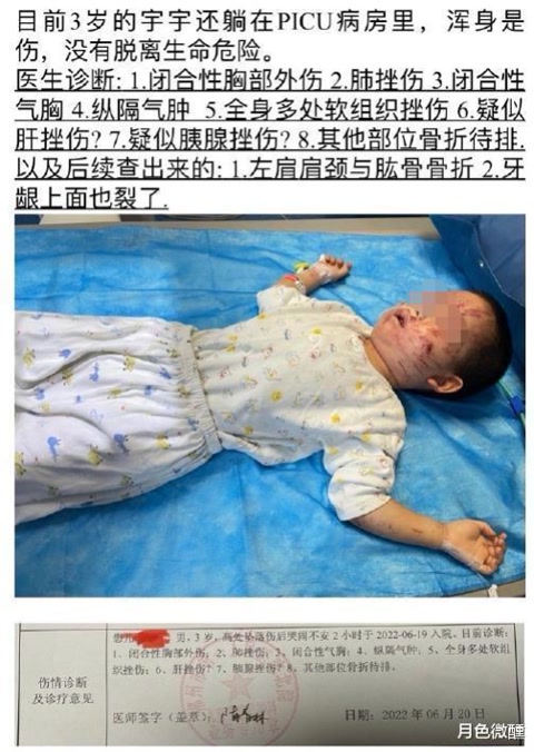 三岁小孩被从17楼推下后续,3岁小孩被男童推下楼梯后续