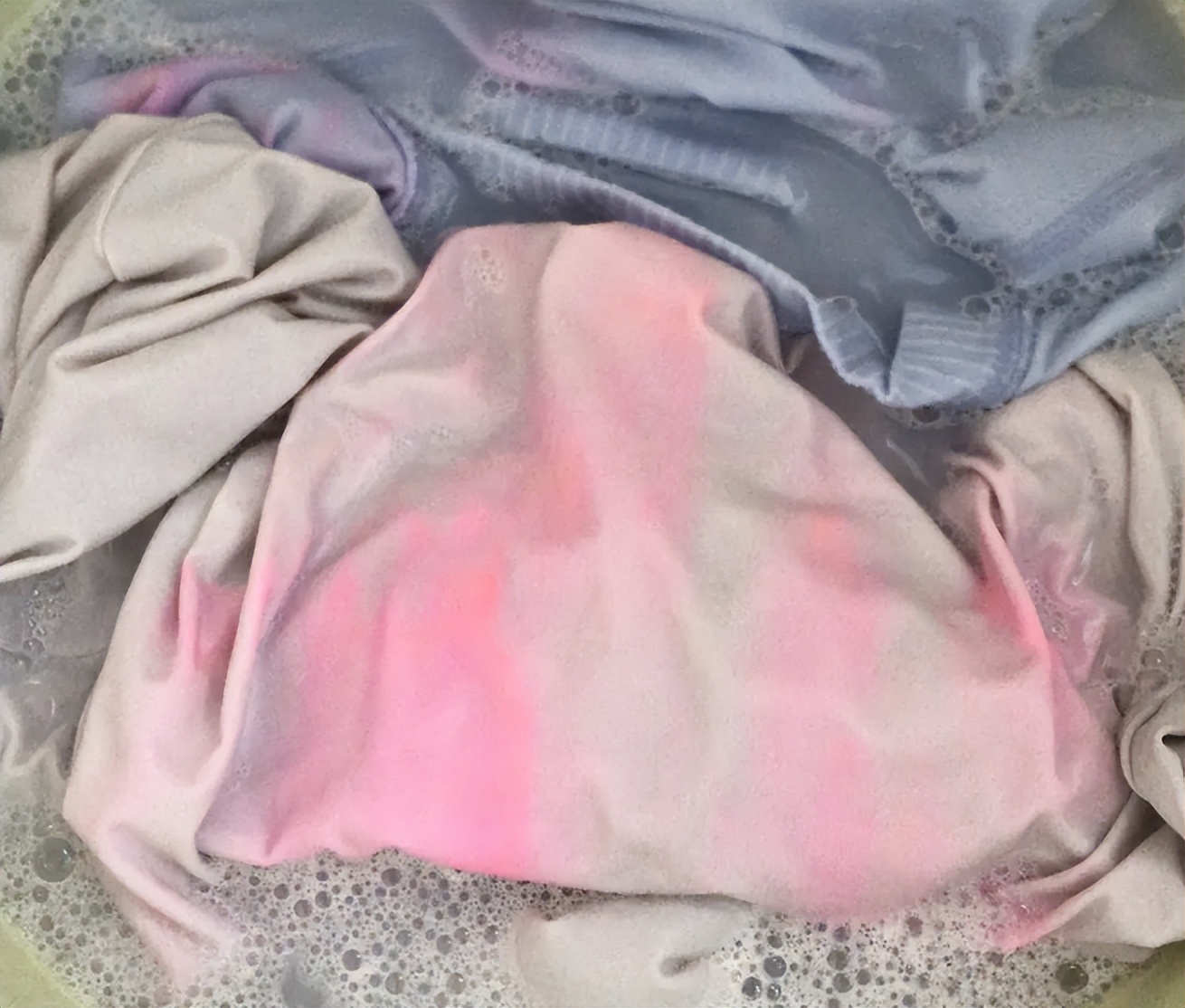 内裤老是脏黄需要换吗,内裤泛黄小妙招