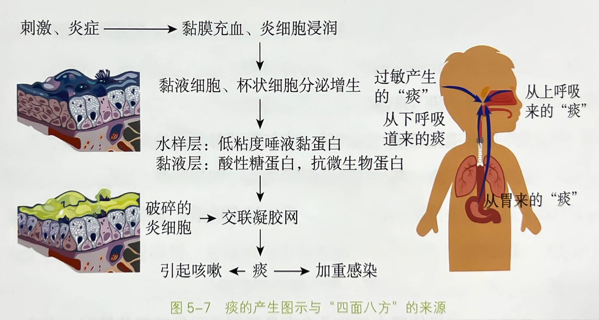 儿童呼吸道感染咳嗽吐白粘痰,呼吸道发痒咳嗽有白痰