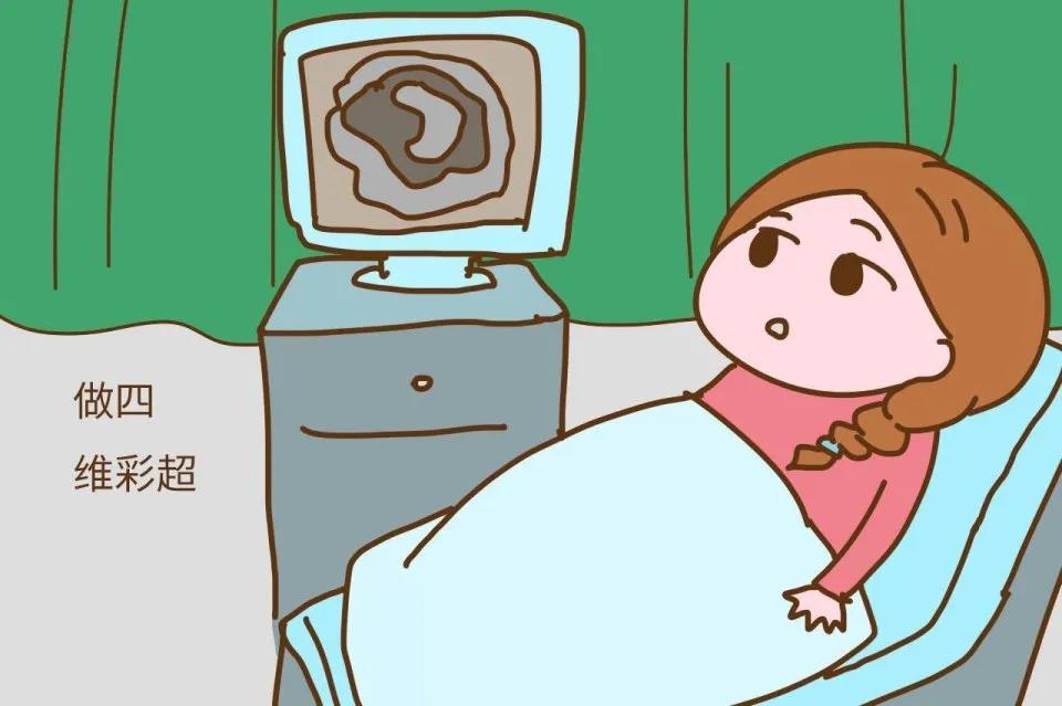 高龄孕妇产检需要做哪些检查项目,怀孕50天去医院产检都有哪些项目