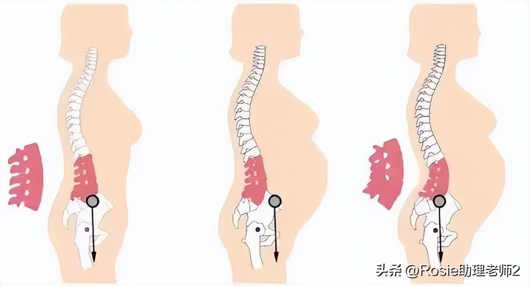 谢娜产后恢复,谢娜产后如何修复