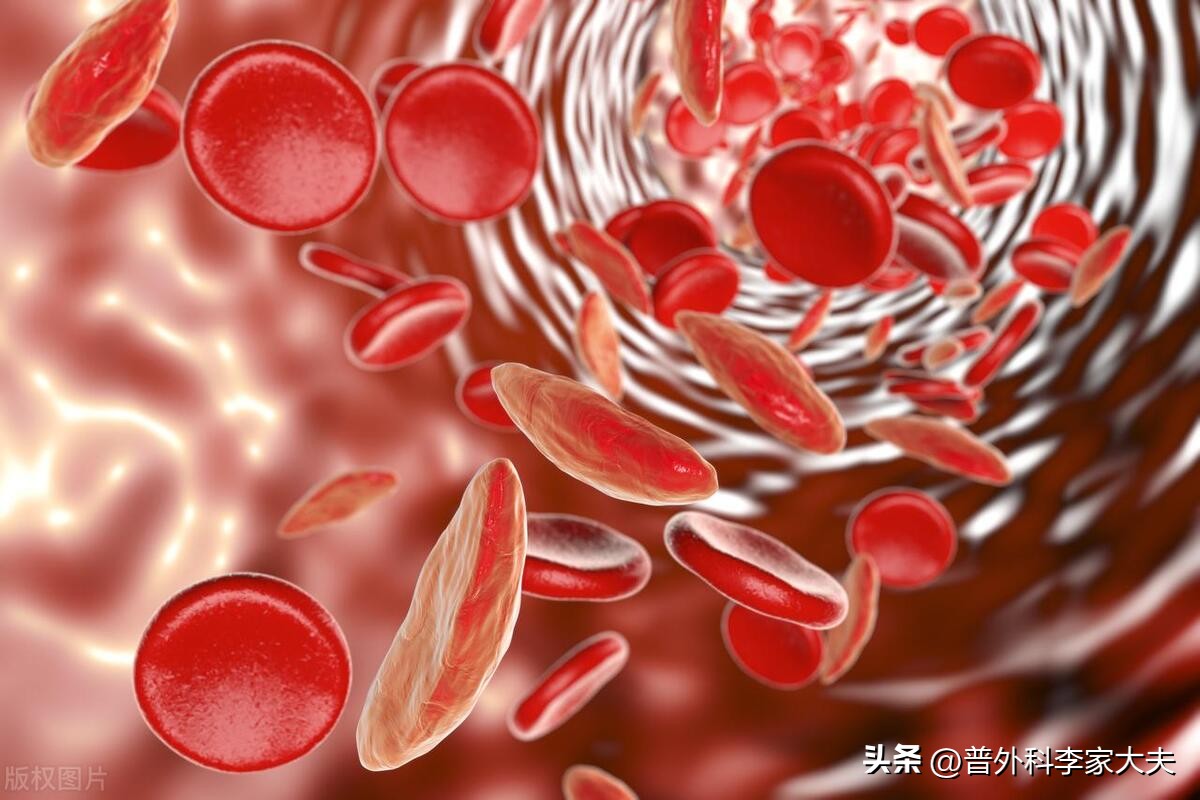肺癌化疗血红蛋白低怎么办,化疗后骨髓抑制血红蛋白低