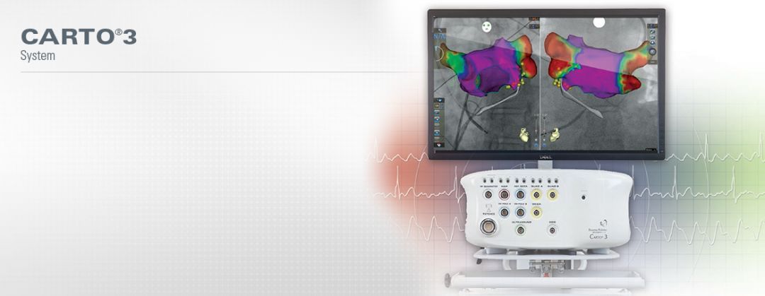 心脏射频消融机器,射频消融导管磁定位型