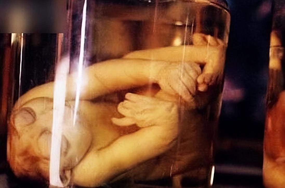 真实恐怖泰国死亡博物馆,泰国恐怖博物馆标本