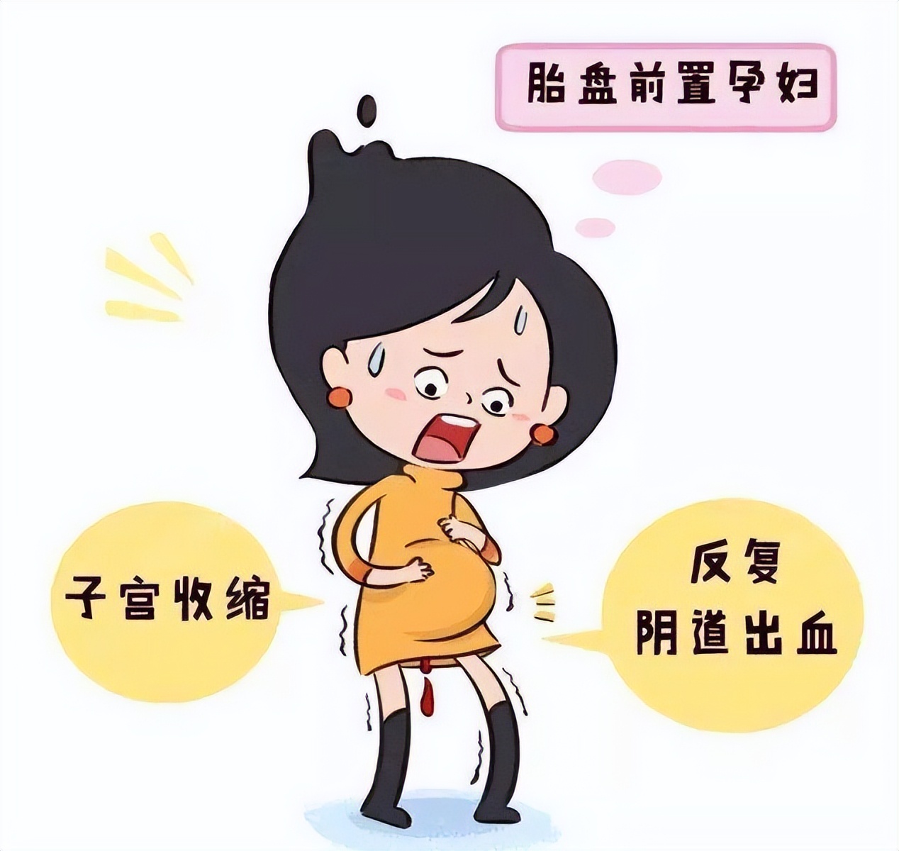 科普怀孕初期要注意什么,胎盘前置是什么意思需要注意什么