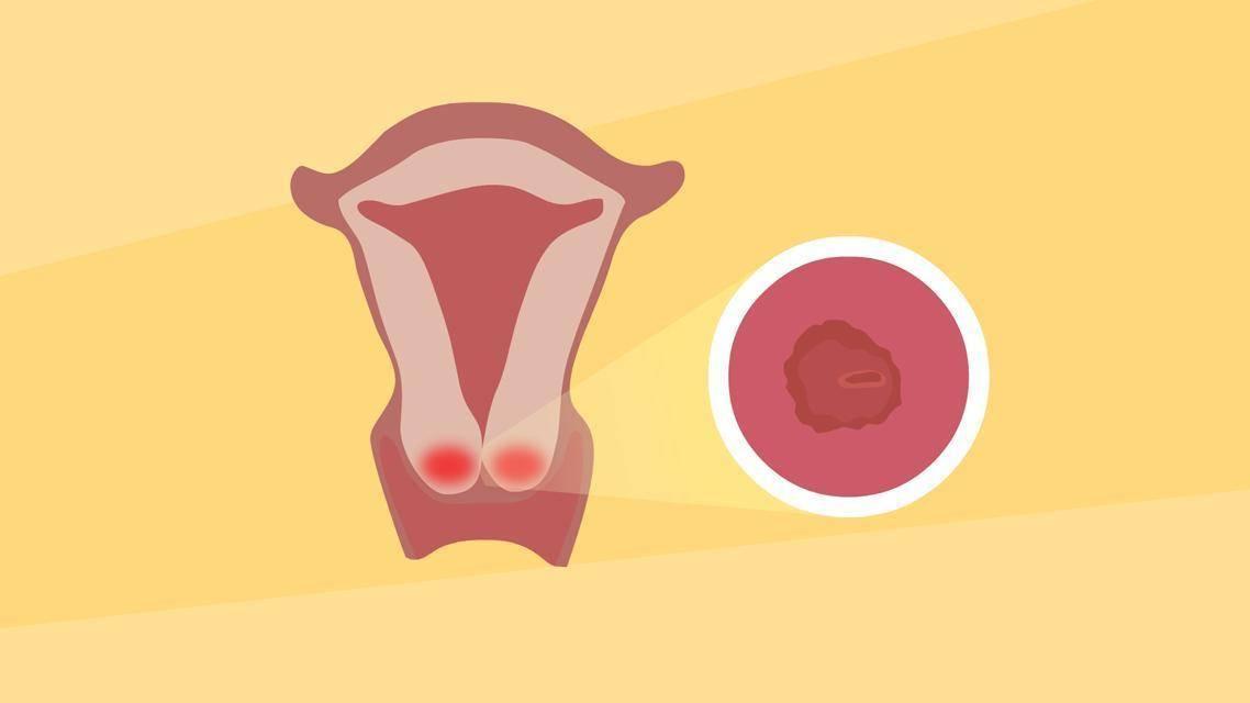 日本为什么女性不得妇科病,日本女性为什么少得妇科病