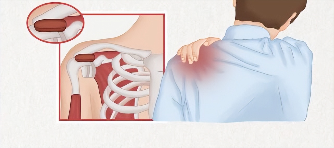 富血小板血浆因子作用,富血小板血浆治疗的目的和意义