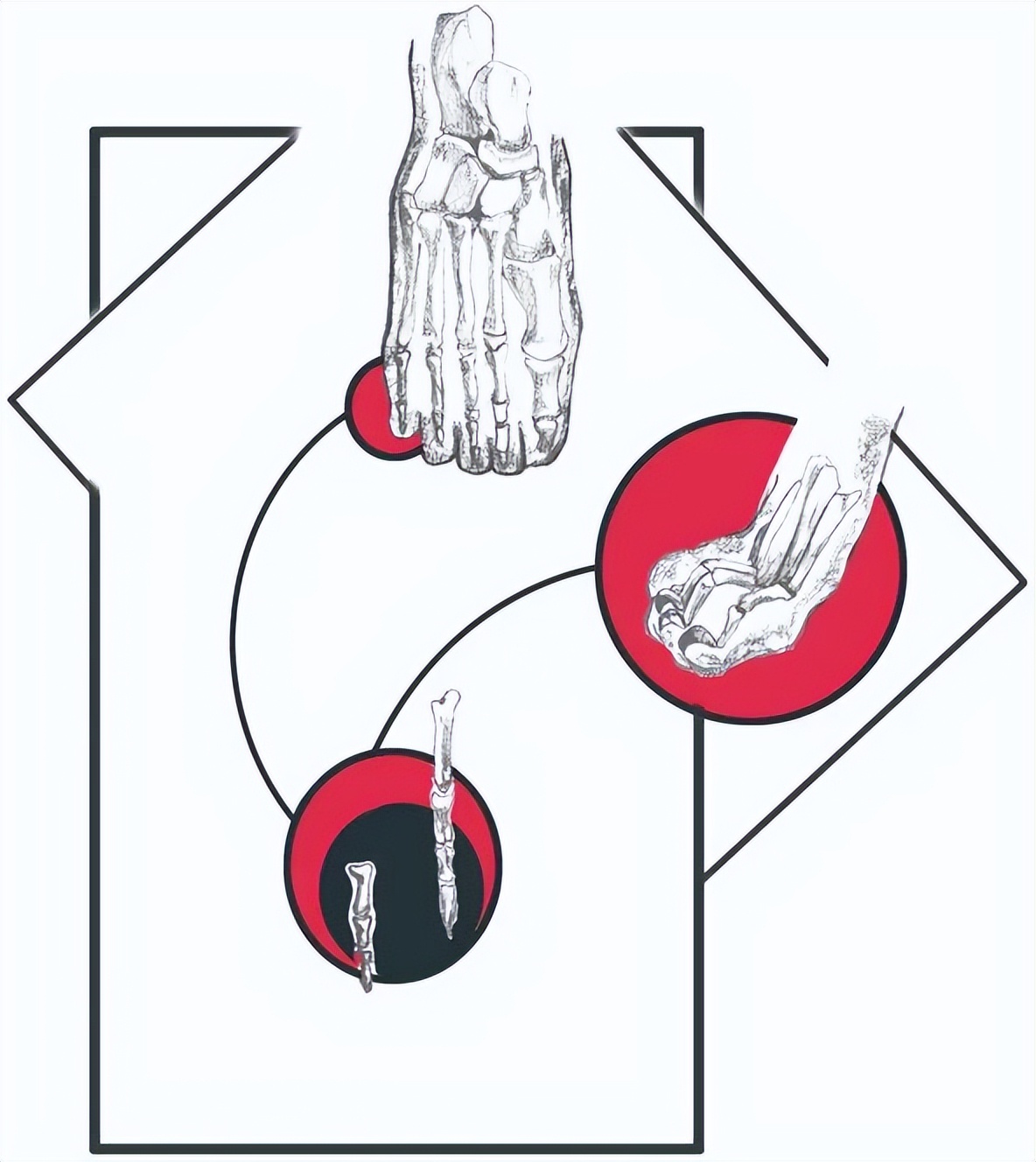 小朋友脚趾被一直撞到痛要怎么办,我们为什么容易崴脚