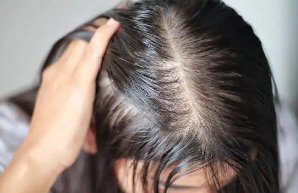 脾胃湿热和肠道湿热吃什么中成药,所有脏腑湿热的症状与治疗中成药