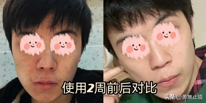 控油美白洗面奶推荐男士真实测评,男士洗面奶控油去螨排行榜前十名