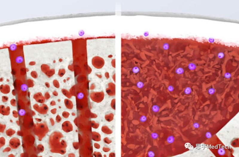 骨再生大咖:瑞士盖氏的故事