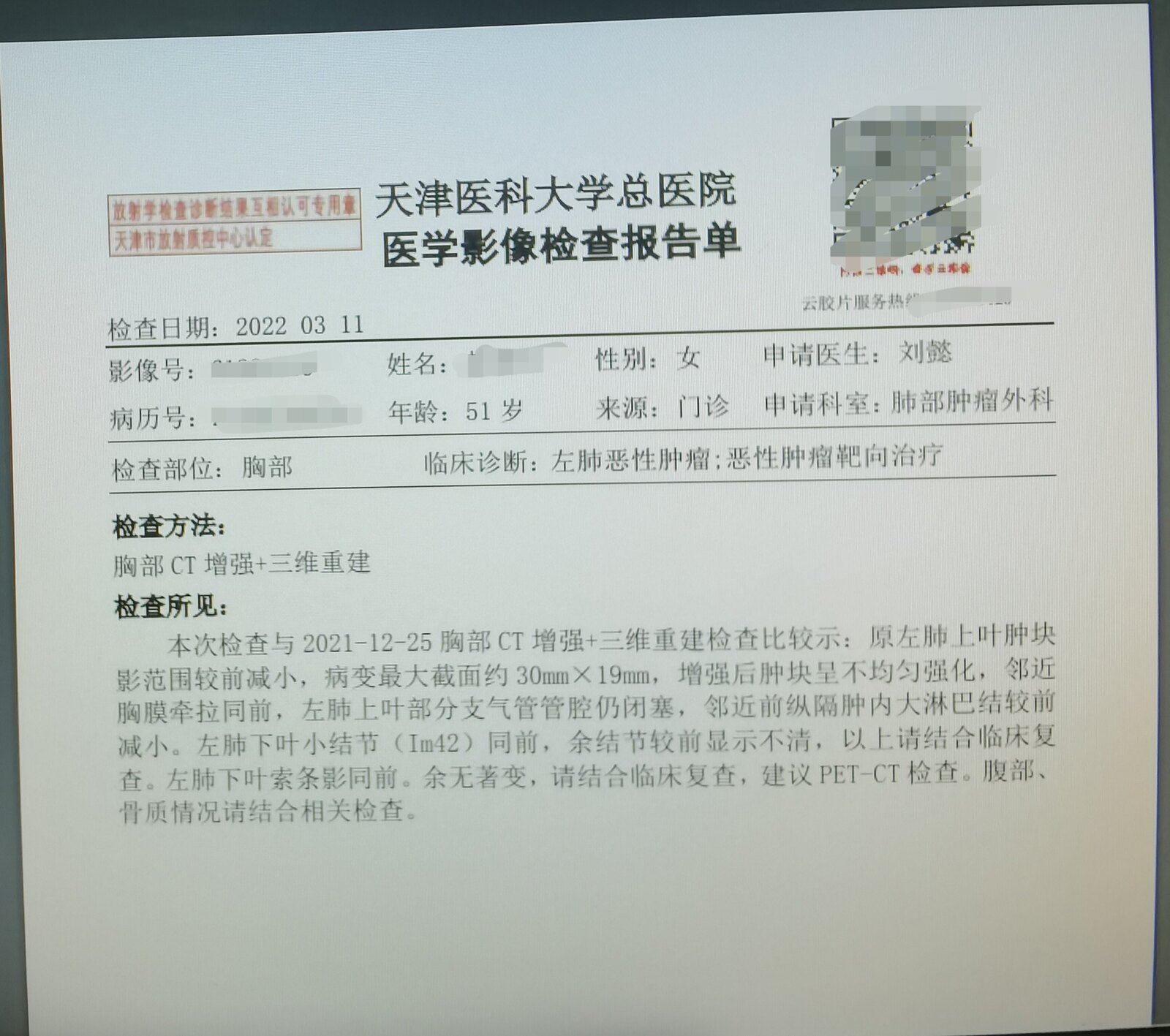 刘懿博士肺癌晚期症状,刘懿博士说肺癌微浸润复发