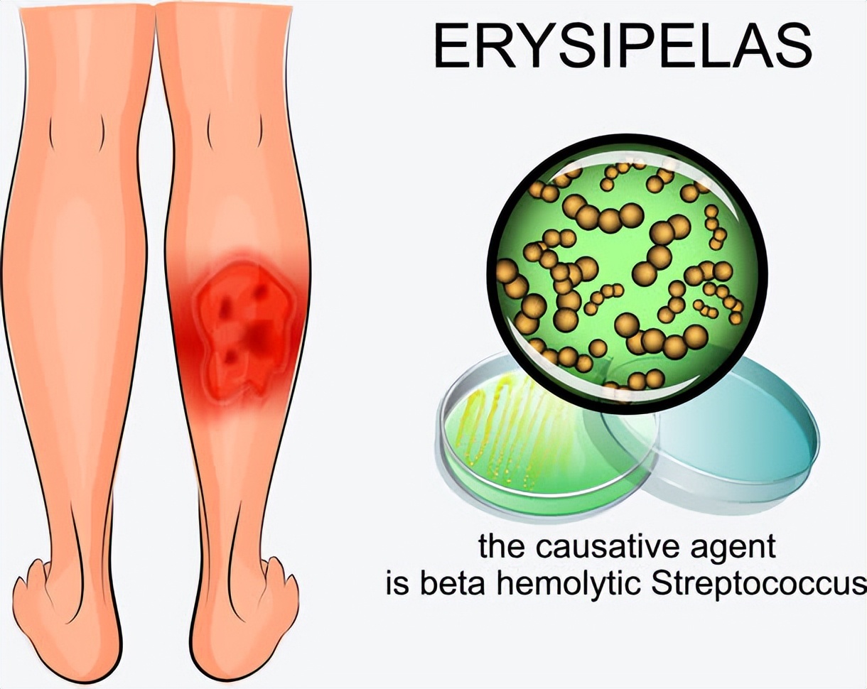 为什么伤口在恢复的时候痒痒的,被人咬了伤口愈合了一直发痒