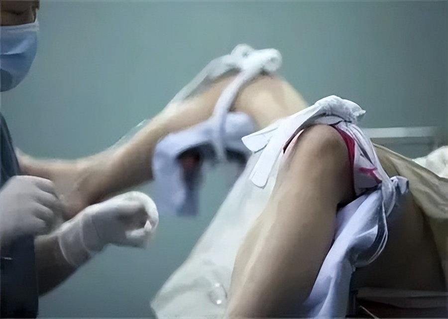 人工流产注意事项及术后康复,人工流产手术危害与风险