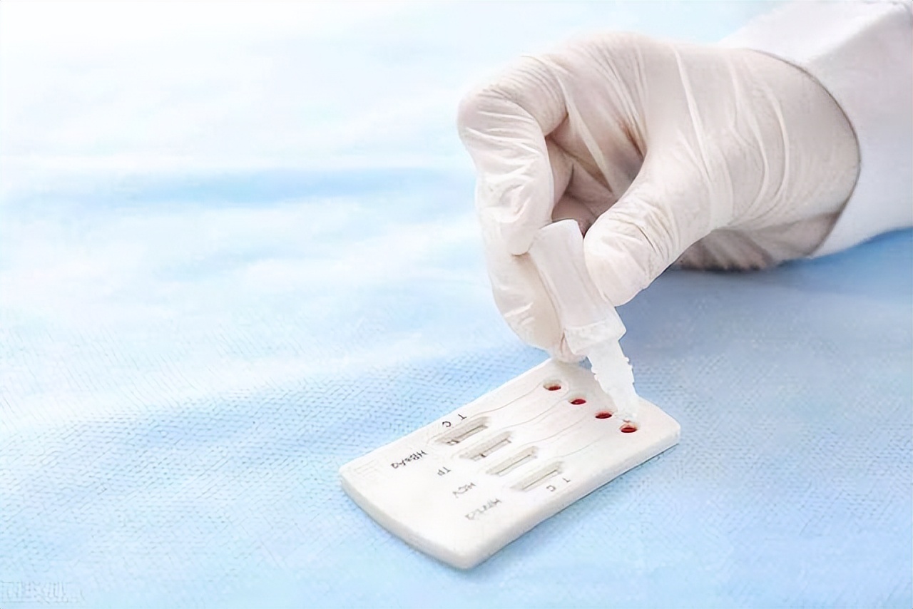 梅毒初期是什么症状梅毒怎么治,得了梅毒会有什么症状