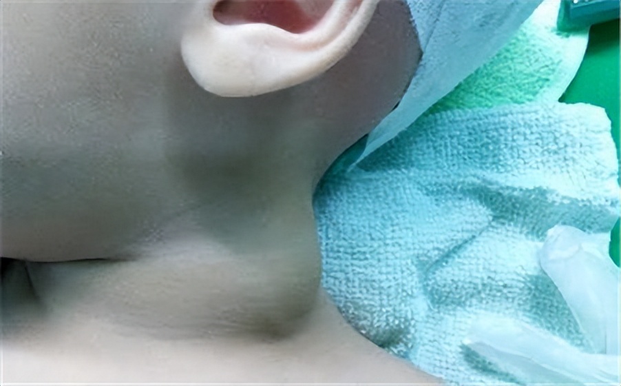 孩子突然出现咀嚼吞咽困难,小孩吃米饭老噎着怎么回事