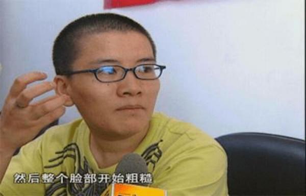 中国首例女变男案例,中国首位女性变男性的人