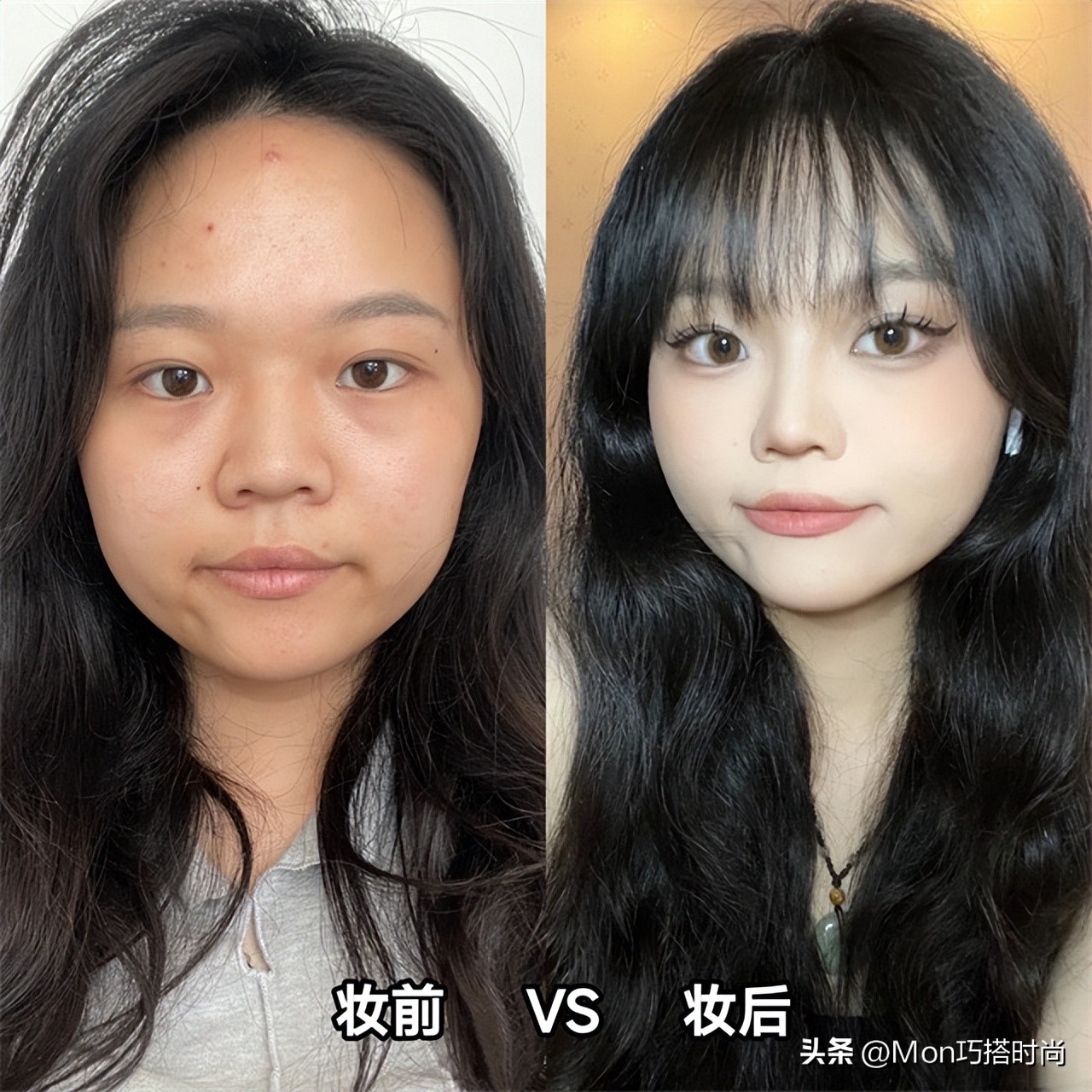 鼻子显凶显老怎么办,鼻子塌陷是不是显得人难看