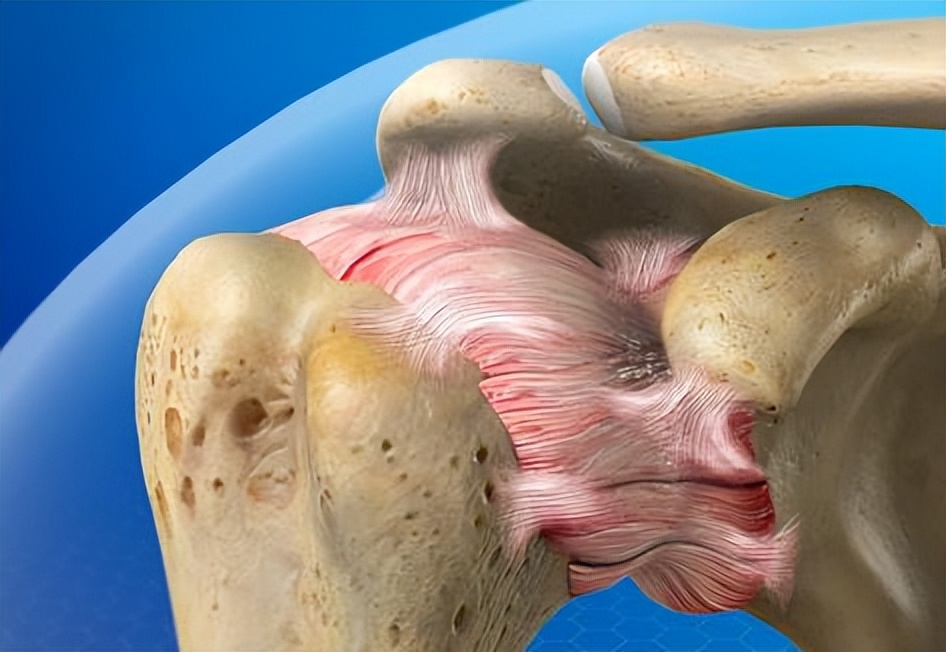 肩周炎最怕什么注意哪些,肩周炎欺软怕硬