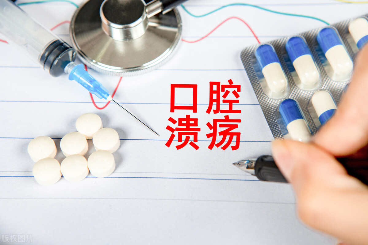 口腔溃疡很疼是不是快好了,口腔溃疡上火怎么止痛