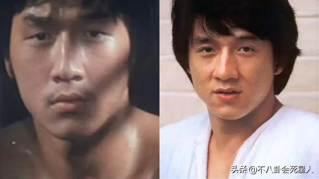 景甜悲伤蛙双眼皮照片,明星割双眼皮前后对比图