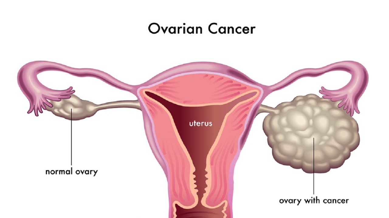 输卵管造影的好处是什么,输卵管造影好处与坏处
