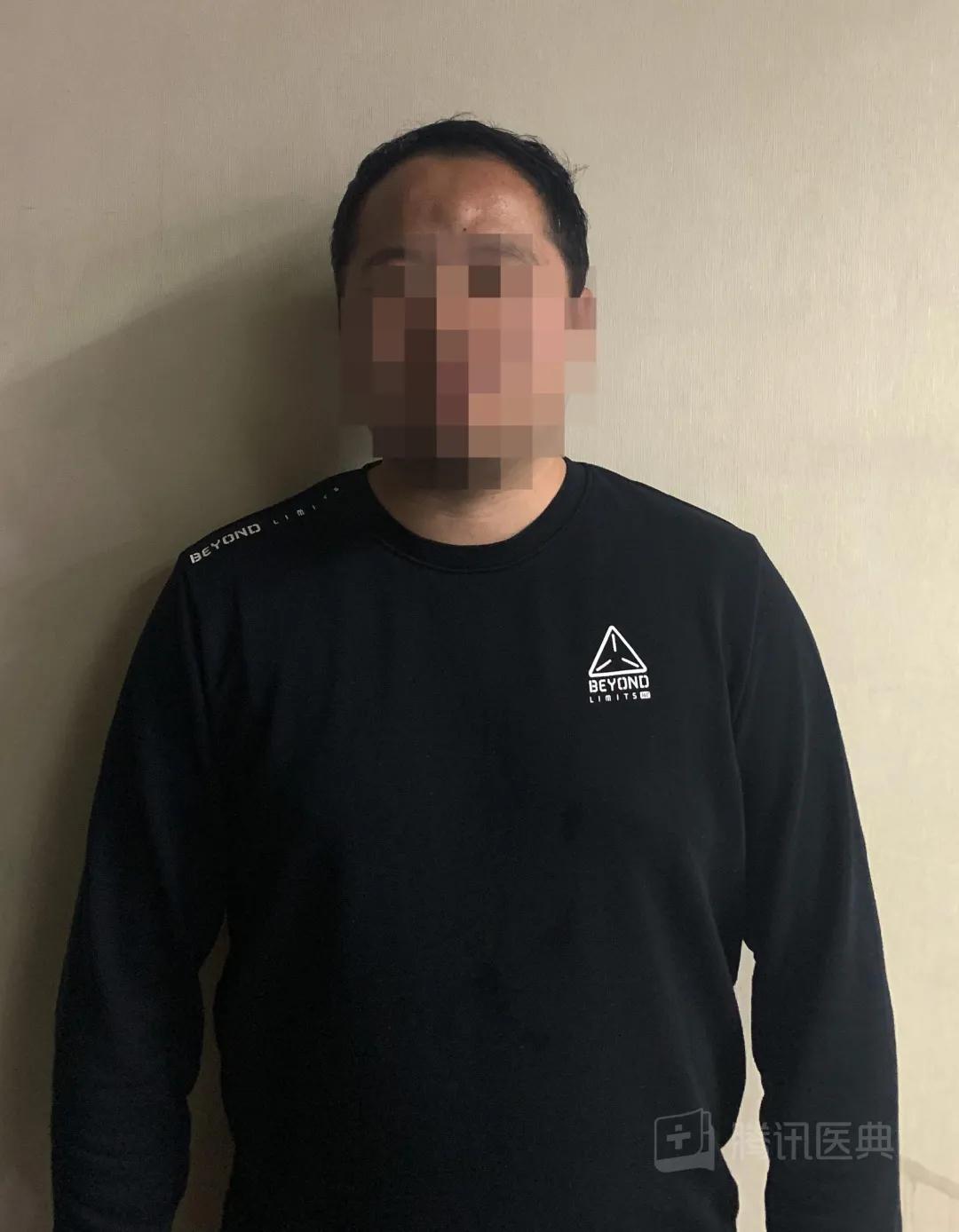 开颅手术后被掀开的头皮多久恢复,开颅手术掀开头皮头皮怎么恢复的