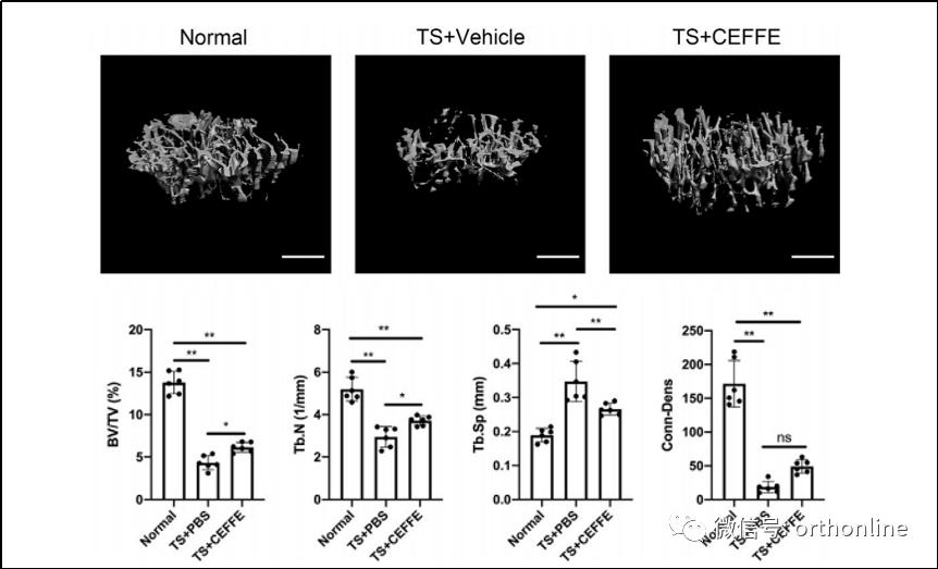 无细胞脂肪活性蛋白预防骨质疏松研究